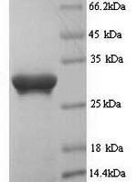 Human Prominin-1 (PROM1), partial Recombinant Protein - BioCrest Sci