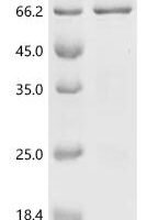 Xenopus laevis Bic-C protein (Bic-C), partial Recombinant Protein - BioCrest Sci