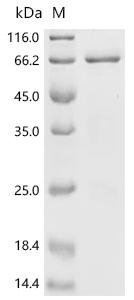 Xenopus laevis Bic-C protein (Bic-C), partial Recombinant Protein, Xenopus laevis (African clawed frog), E.coli, N-terminal 6xHis-SUMO-tagged, 68.6 kDa, purity >≥ 85% as determined by SDS-PAGE.
