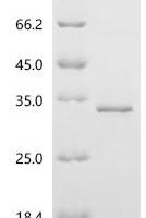 Human StAR-related lipid transfer protein 6 (STARD6) Recombinant Protein - BioCrest Sci