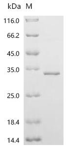 Human StAR-related lipid transfer protein 6 (STARD6) Recombinant Protein, Homo sapiens (Human), E.coli, C-terminal 6xHis-tagged, 32.0 kDa, purity >≥ 90% as determined by SDS-PAGE.