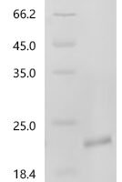 Human Inhibin beta C chain (INHBC), partial Recombinant Protein - BioCrest Sci