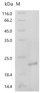Human Inhibin beta C chain (INHBC), partial Recombinant Protein, Homo sapiens (Human), E.coli, N-terminal 6xHis-tagged, 19.4 kDa, purity >≥ 90% as determined by SDS-PAGE.