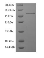 Human Lactadherin (MFGE8) Recombinant Protein - BioCrest Sci