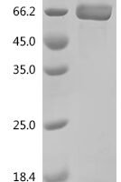 Human Metabotropic glutamate receptor 5 (GRM5), partial Recombinant Protein, C-His, aa 22–580 - BioCrest Sci