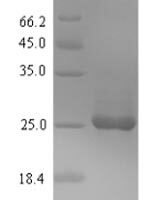 Glycine max  Bowman-Birk type proteinase inhibitor D-II Recombinant Protein - BioCrest Sci