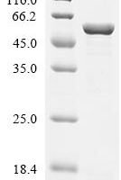 Salmonella typhimurium ATP synthase subunit beta (atpD) Recombinant Protein - BioCrest Sci