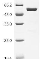 pig Tripartite motif-containing protein 72(TRIM72) Recombinant Protein - BioCrest Sci