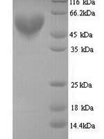 Clostridium butyricum Botulinum neurotoxin type E, partial Recombinant Protein - BioCrest Sci