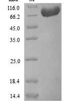 Human Prothrombin (F2) Recombinant Protein, N-His - BioCrest Sci