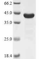 Rat Cathepsin D (Ctsd) Recombinant Protein - BioCrest Sci