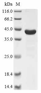 Rat Cathepsin D (Ctsd) Recombinant Protein, Rattus norvegicus (Rat), E.coli, N-terminal 10xHis-tagged and C-terminal Myc-tagged, 45.2 kDa, purity >≥ 90% as determined by SDS-PAGE.
