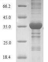 Human High mobility group nucleosome-binding domain-containing protein 4 (HMGN4) Recombinant Protein - BioCrest Sci