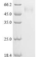 Human Signal recognition particle subunit SRP54 (SRP54) Recombinant Protein, N-His - BioCrest Sci