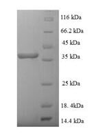 Staphylococcus aureus Enterotoxin type H (entH) Recombinant Protein, N-His-SUMO - BioCrest Sci