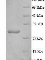 Drimia maritima Ribosome-inactivating protein charybdin Recombinant Protein, N-His - BioCrest Sci