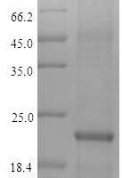 Human Zinc finger protein 160 (ZNF160) Recombinant Protein - BioCrest Sci