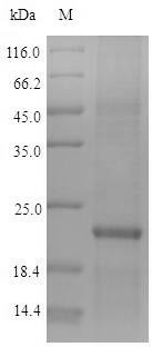 Human Zinc finger protein 160 (ZNF160) Recombinant Protein, Homo sapiens (Human), E.coli, N-terminal 10xHis-tagged and C-terminal Myc-tagged, 22.1 kDa, purity >≥ 90% as determined by SDS-PAGE.