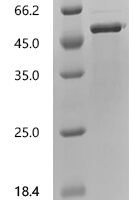 Human Galactose-1-phosphate uridylyltransferase (GALT) Recombinant Protein, C-His, aa 1–379, E.coli - BioCrest Sci