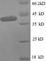 Escherichia coli 50S ribosomal protein L9 (rplI), partial Recombinant Protein - BioCrest Sci