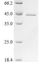 Bovine Alpha-actinin-4 (ACTN4), partial Recombinant Protein - BioCrest Sci