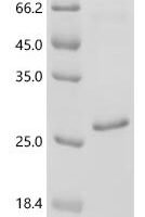 Human Rhombotin-1 (LMO1) Recombinant Protein - BioCrest Sci
