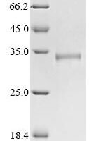 Bovine coronavirus Non-structural protein 2a (2a) Recombinant Protein, C-His, aa 1–278, strain 98TXSF-110-LUN - BioCrest Sci