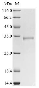 Bovine coronavirus Non-structural protein 2a (2a) Recombinant Protein, C-His, aa 1–278, strain 98TXSF-110-LUN, Bovine coronavirus (strain 98TXSF-110-LUN) (BCoV-LUN) (BCV), Mammalian cell, C-terminal 6xHis-tagged, 34.4 kDa, purity >≥ 85% as determined by SDS-PAGE.