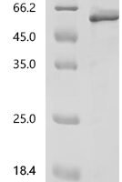 Mouse Nuclear factor NF-kappa-B p105 subunit (Nfkb1), partial Recombinant Protein - BioCrest Sci