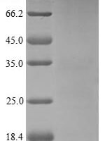 Human Neutrophil defensin 3 (DEFA3) Recombinant Protein - BioCrest Sci