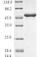 Human Sperm-associated antigen 16 protein (SPAG16) Recombinant Protein - BioCrest Sci