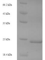 Micrurus tener tener Kunitz-type neurotoxin MitTx-alpha Recombinant Protein, N-His-SUMO - BioCrest Sci