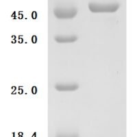 Mouse Tumor necrosis factor ligand superfamily member 13B (Tnfsf13b), partial Recombinant Protein - BioCrest Sci