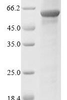 Human Propionyl-CoA carboxylase beta chain, mitochondrial (PCCB) Recombinant Protein - BioCrest Sci