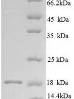 Bovine Angiogenin-1 (ANG1) Recombinant Protein - BioCrest Sci