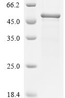 Mouse Slit homolog 2 protein (Slit2), partial Recombinant Protein, N-10His/C-Myc - BioCrest Sci