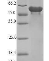 Human F-box only protein 2 (FBXO2) Recombinant Protein, N-GST - BioCrest Sci
