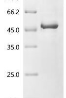 Human Glycogen synthase kinase-3 beta (GSK3B) Recombinant Protein, N-Flag - BioCrest Sci