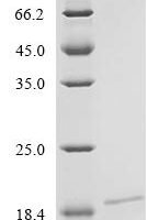 Human Islet amyloid polypeptide (IAPP) Recombinant Protein - BioCrest Sci