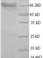 Human Aspartyl aminopeptidase (DNPEP) Recombinant Protein - BioCrest Sci