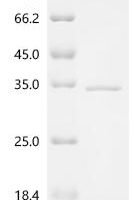 Human Serine/threonine-protein kinase B-raf (BRAF), partial Recombinant Protein - BioCrest Sci