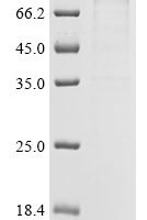 Human DNA polymerase theta (POLQ), partial Recombinant Protein, N-His-SUMO - BioCrest Sci
