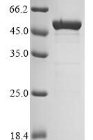 Leishmania infantum Thymine dioxygenase JBP1 (JBP1), partial Recombinant Protein - BioCrest Sci