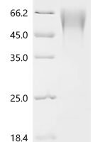 Human metapneumovirus Major surface glycoprotein G (G), partial Recombinant Protein, C-10His - BioCrest Sci