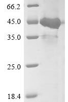Human herpesvirus 6A Glycoprotein 105 (U96/U97/U98/U99/U100), partial Recombinant Protein - BioCrest Sci