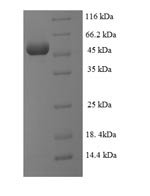 Human Transcription initiation protein SPT3 homolog (SUPT3H), partial Recombinant Protein, Homo sapiens (Human), E.coli, N-terminal 6xHis-SUMO-tagged, 53.4 kDa, purity >≥ 90% as determined by SDS-PAGE.