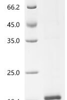 Galleria mellonella Odorant-binding protein (OBP7) Recombinant Protein - BioCrest Sci
