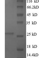 Bovine Metalloproteinase inhibitor 4 (TIMP4) Recombinant Protein, N-His, aa 30–224, E.coli - BioCrest Sci