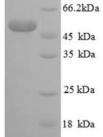 Human Large ribosomal subunit protein eL14 (RPL14), partial Recombinant Protein - BioCrest Sci