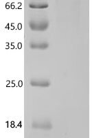 Human Cysteine-rich protein 2-binding protein (KAT14) Recombinant Protein, C-His - BioCrest Sci